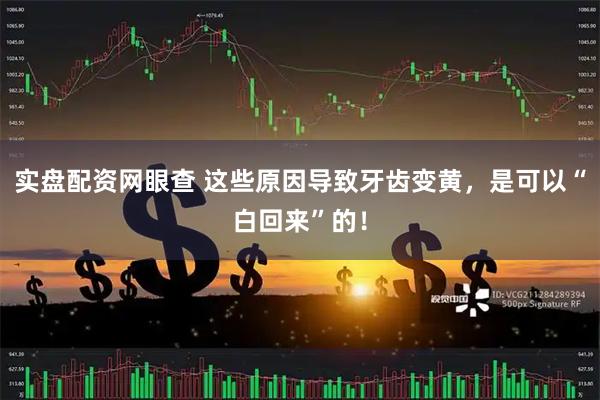 实盘配资网眼查 这些原因导致牙齿变黄，是可以“白回来”的！